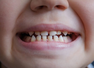 pediatric dentists