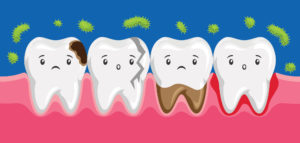 affected tooth extraction