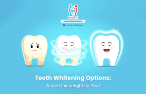 Teeth Whitening