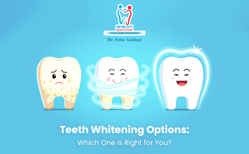Teeth Whitening Options: Which One is Right for You?