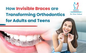 invisible braces