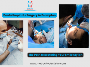 Dental Implants Surgery in Brampton