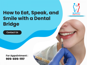 dental fix bridge