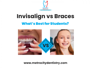 Invisalign dental Treatment