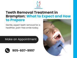Teeth Removal Treatment Brampton