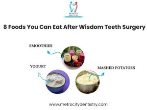 wisdom tooth extractions