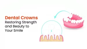 Dental Crown